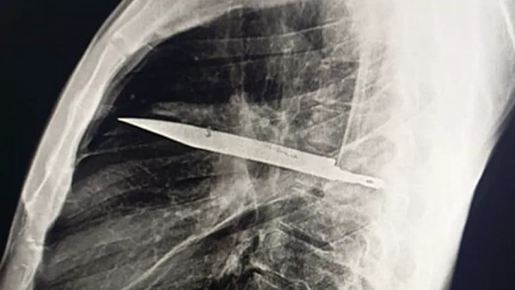 Journal Of Surgical Case Repor