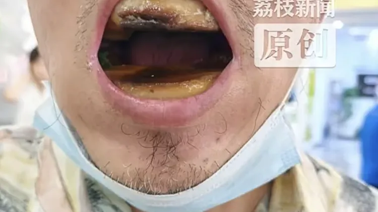 עשה לעצמו טיפול שיניים כדי לחסוך כסף