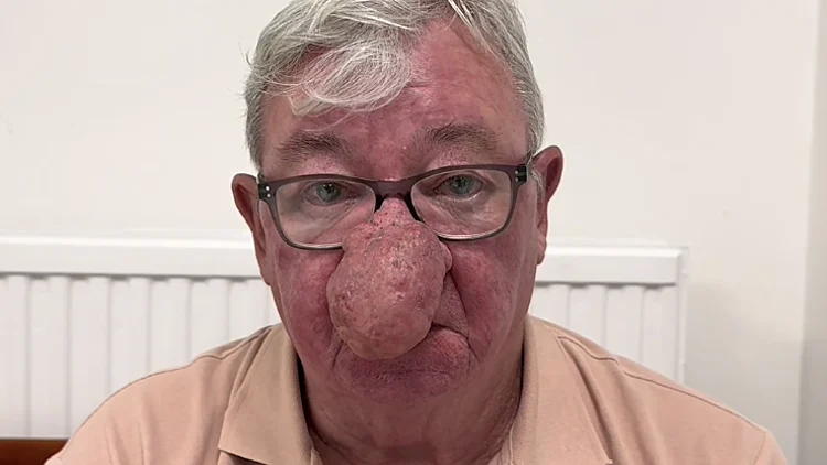 גראלד מקאליס