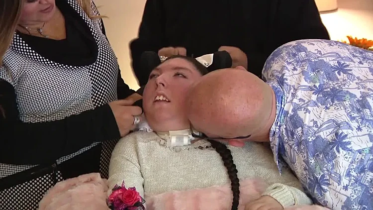 אלכס סימפסון