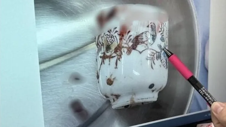 הכוס שנמצאה בגופו של הטופל