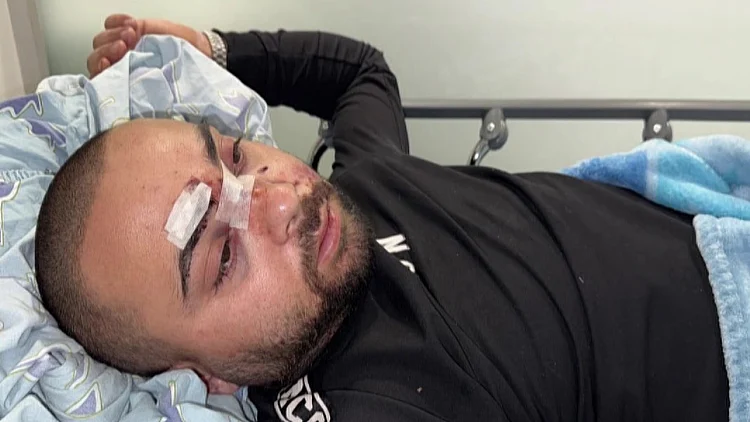 צעירים ערבים הותקפו על רקע גזעני בתל אביב: "אין צדק במדינה"