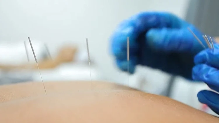 עברה דיקור סיני - וכמעט איבדה את ראייתה: "אני במצב היסטרי"