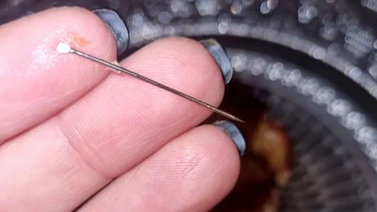 נפצעה ממחט שהייתה בתוך תמר: "מזל שזו אני ולא הילדה שלי"