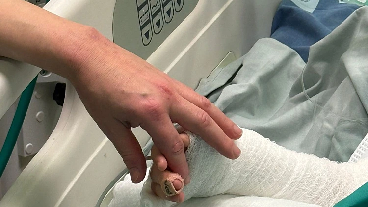 ילד עם כוויות בבית החולים לצד אימו