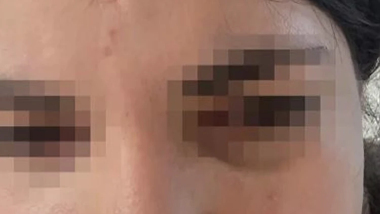 "התחננתי שיפסיקו, חששתי שהן ישלפו סכין וישאירו אותי שם"