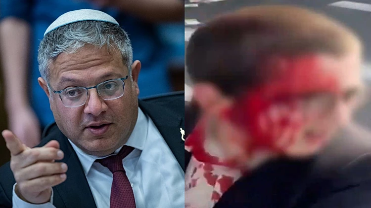 האלימות המשטרתית בהפגנות - והתשובה השערורייתית של בן גביר