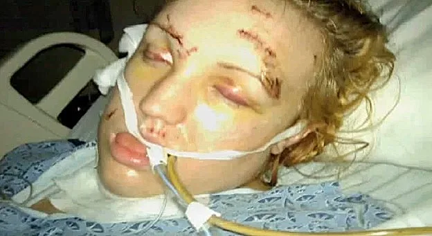 הצעת הנישואין של קמרון היל ומליסה דוהם