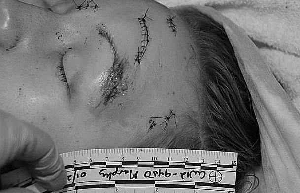 הצעת הנישואין של קמרון היל ומליסה דוהם