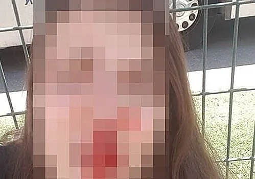 האישה שנחשד כי הותקפה בעפולה ע