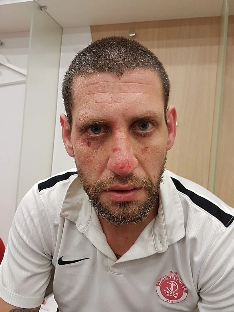 רמי אינגל, הפיזיותרפיסט של הפועל ת