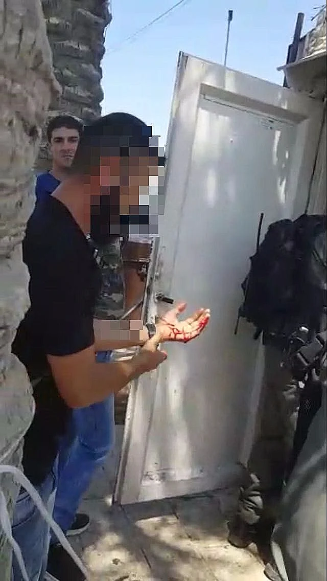 תושב מזרח ירושלים שנפצע קל מאוד מדקירה בסמוך לשער שכם