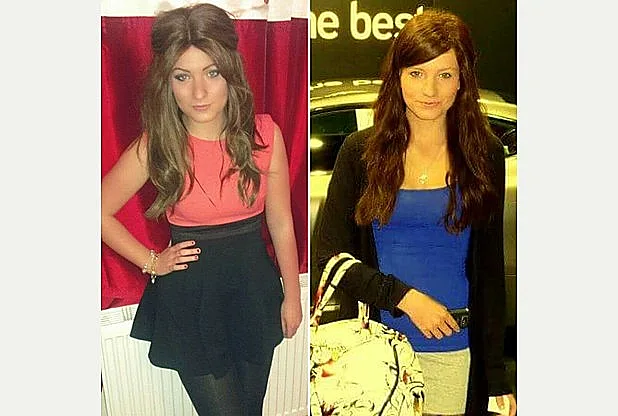 חושפת את המחלה שגורמת לה להקריח