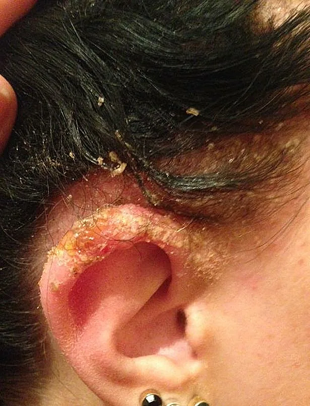 כמעט איבדה את חייה בגלל צבע לשיער