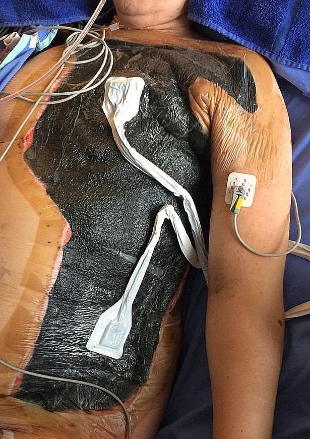 כמעט מתה בגלל משחק מחניים