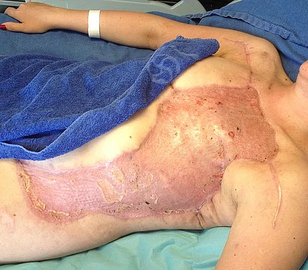 כמעט מתה בגלל משחק מחניים