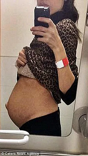 הבטן ההיריונית התגלתה כגידול ענק