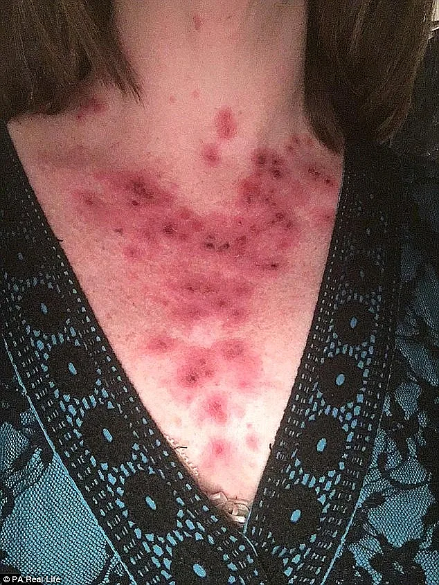 התמונה שעזרה לה לגלות את הסרטן