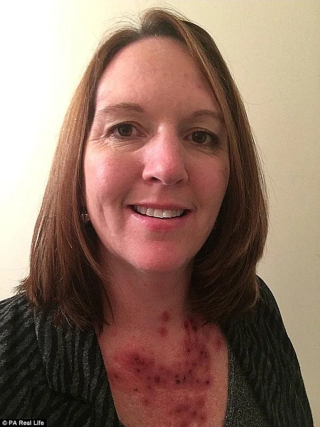 התמונה שעזרה לה לגלות את הסרטן