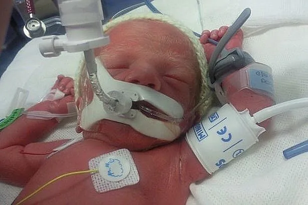 נס רפואי: החזיק מעמד וניצל מהפגות