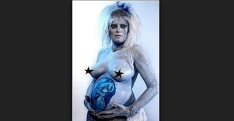 תמונות היריון מוזרות