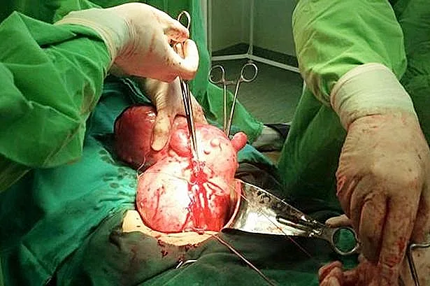 אישה בהיריון נחרדה לגלות: זה היה גידול