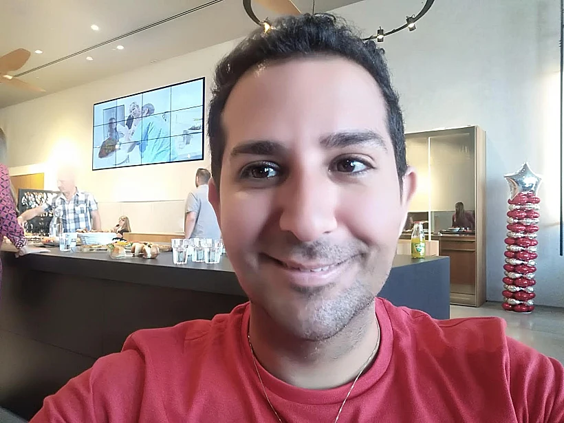 דודי טל אחרי הבוטוקס (פרטי )