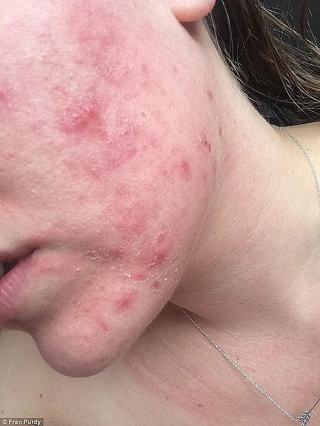 עברה שיימינג ברשת בגלל איפור