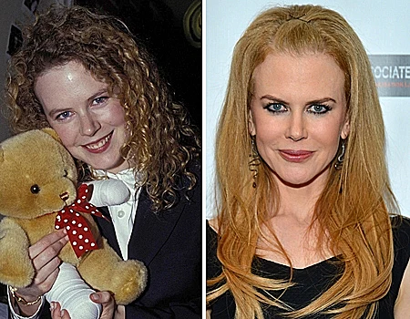 ניקול קידמן