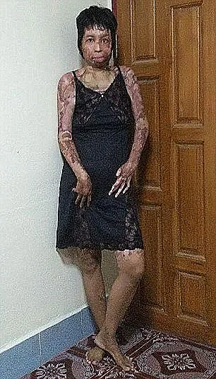 הבעיר את אשתו