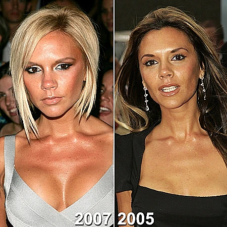 עשתה או לא עשתה ניתוח להגדלת החזה?