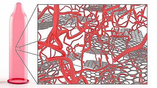 קונדום דור העתיד