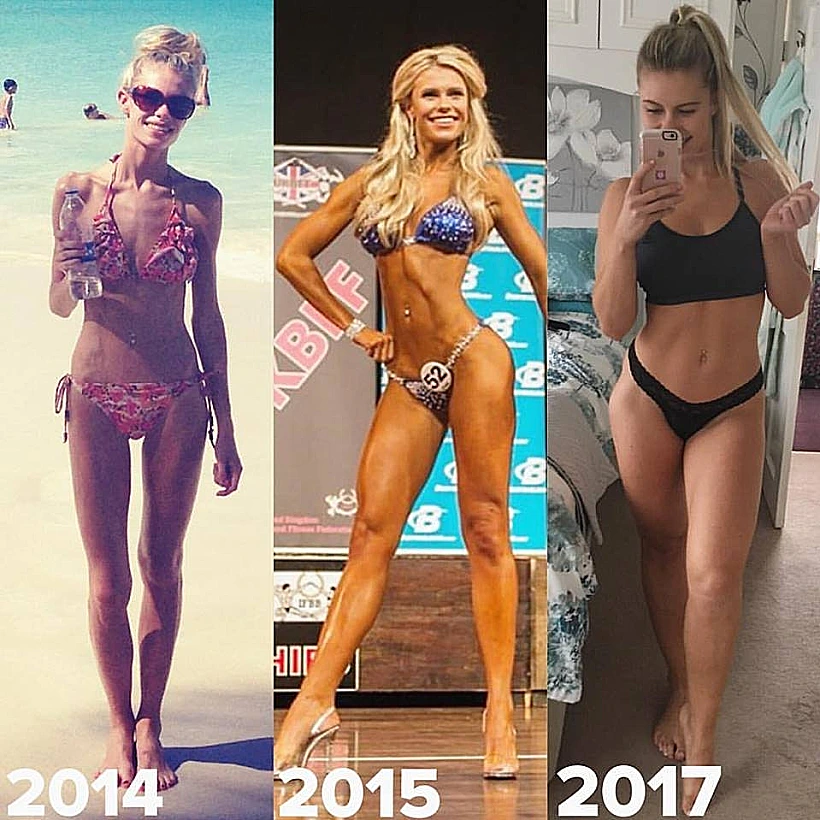 השתקמה מאנורקסיה בזכות המשקולות