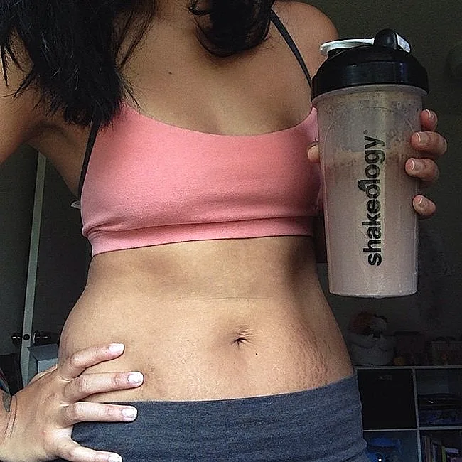 בטן נשית לאחר לידה