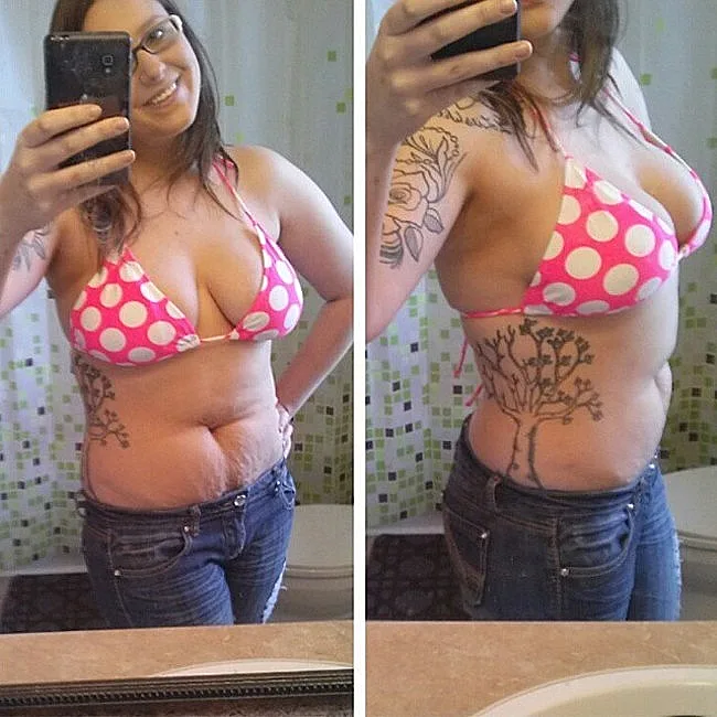 בטן אחרי לידה