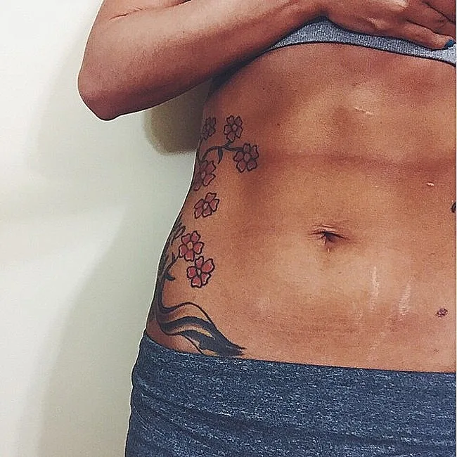 בטן אחרי לידה