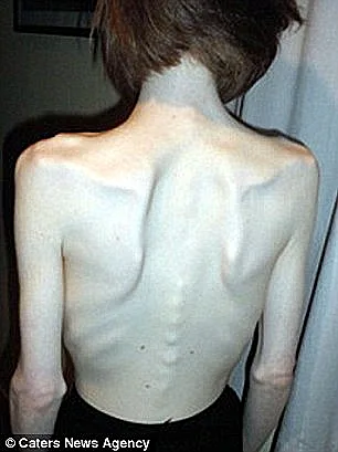 שוק! חיה על 10 קלוריות ביום