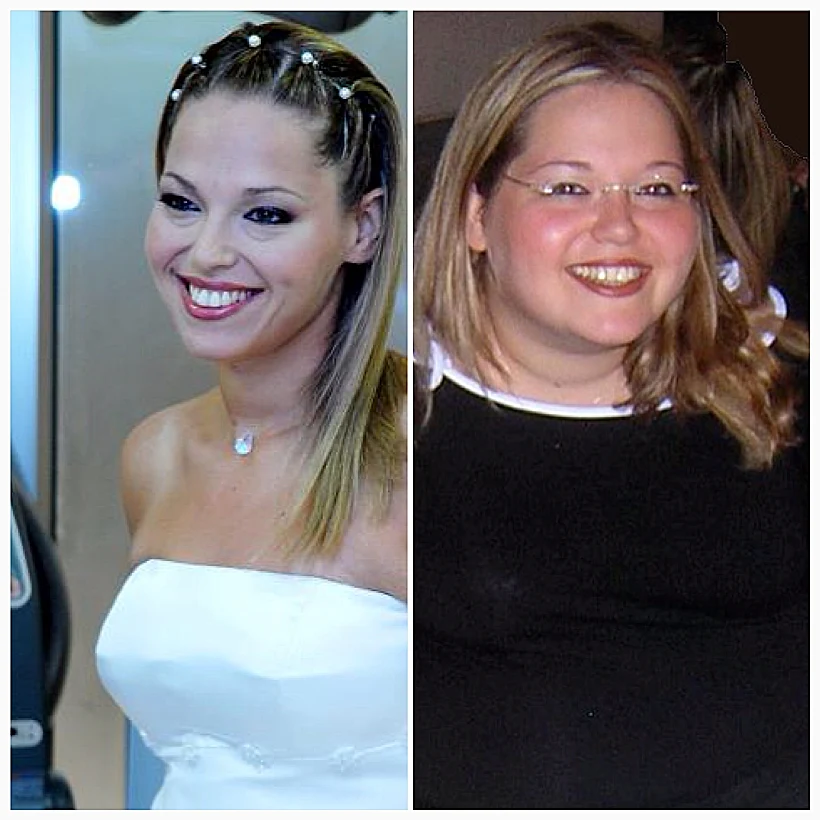 שירה ירדה 72 קילו בגלל קלקול קיבה