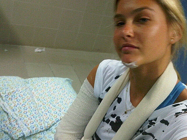 בר רפאלי בגבס