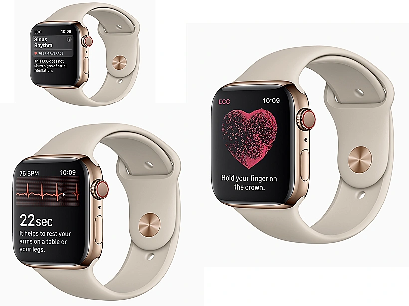 השעון של אפל הופך לאביזר רפואי