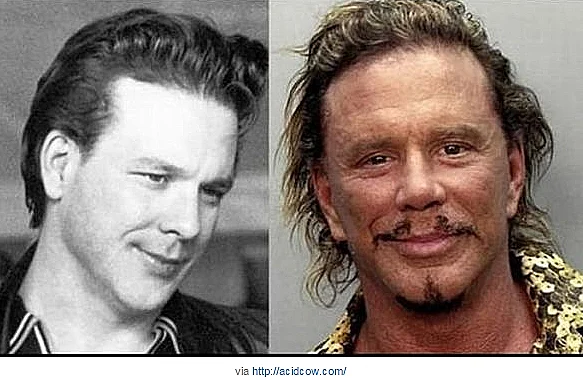 המפורסמים שהזקנה לא עשתה להם טוב