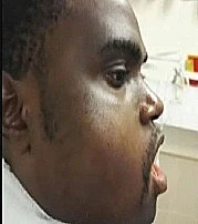 מנותח בבית חולים ישראלי בגינאה