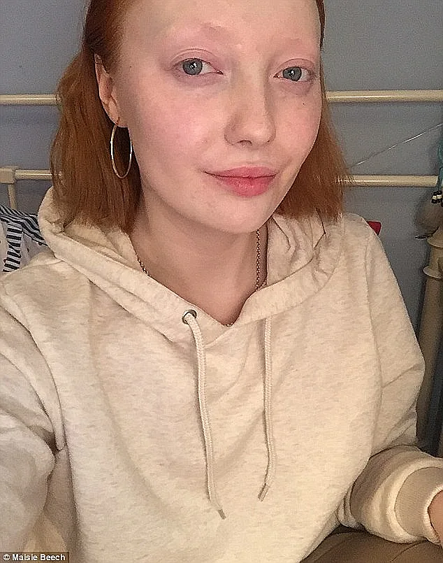 עברה שיימינג ברשת בגלל איפור