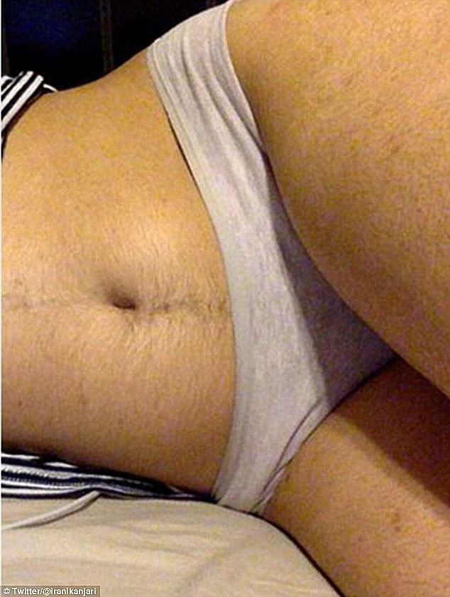 האישה שדורשת שתתנו לה לגדל פלומה בשקט