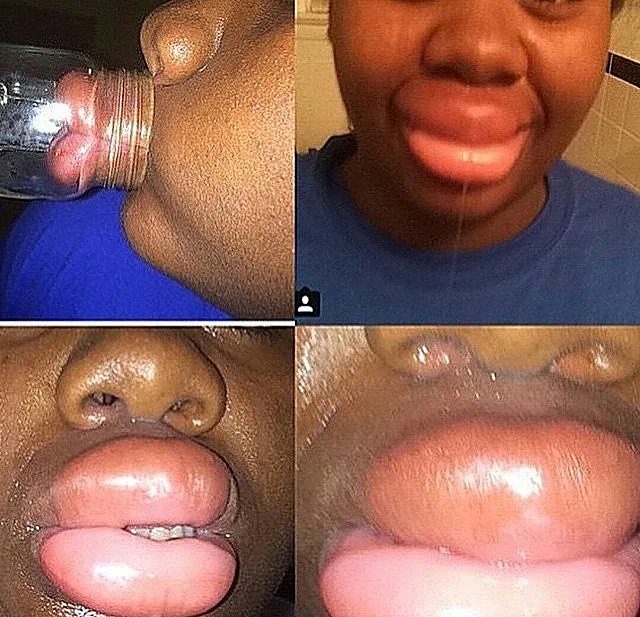 טרנד השפתיים המשתלט