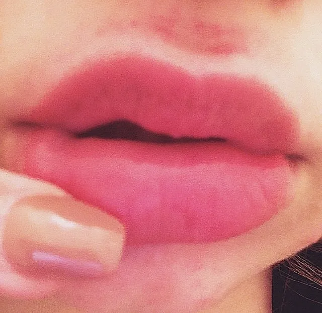 טרנד השפתיים המשתלט