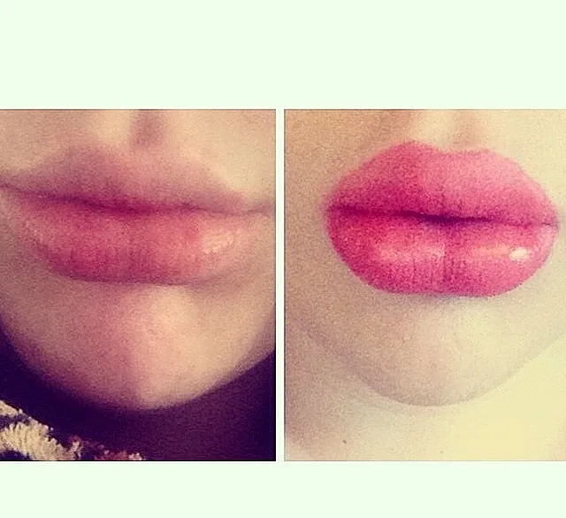 טרנד השפתיים המשתלט