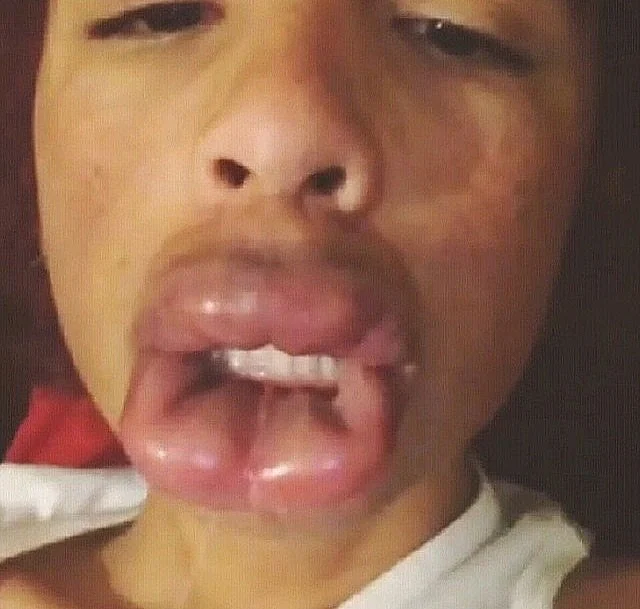 טרנד השפתיים המשתלט