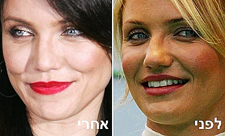 קמרון דיאז לפני ואחרי ניתוח אף