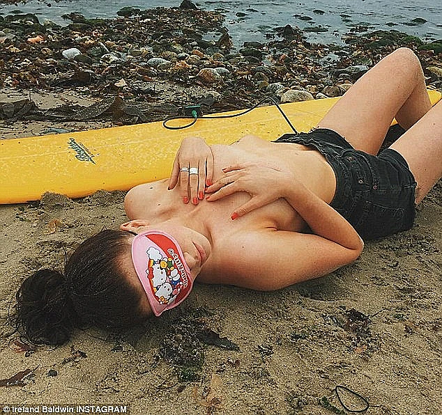 אירלנד בולדויין